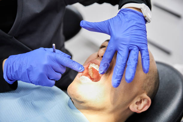 Best Knocked-Out Tooth (Avulsed Tooth) Treatment in Westbrook Center, CT